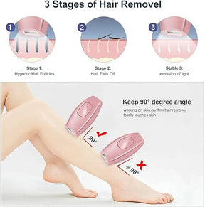 Mini Laser Hair Removal (إزالة الشعر بالليزر المصغر)