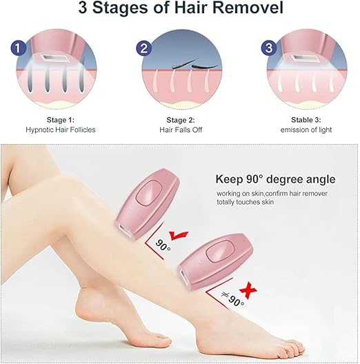 Mini Laser Hair Removal (إزالة الشعر بالليزر المصغر)